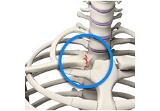 Sternoclavicular Joint (SC joint) Disorders