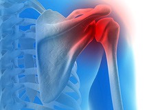 Baseball and Shoulder Injuries