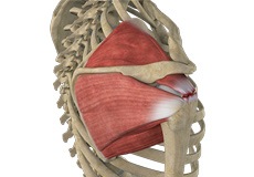 Massive Retracted Rotator Cuff Tear