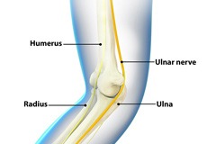 Ulnar Nerve Transposition