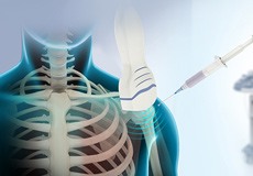 Ultrasound-Guided Shoulder Injections